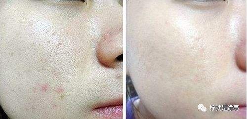 吃鸡皮肤爆料最新车皮肤,吃鸡战场再添炫酷座驾